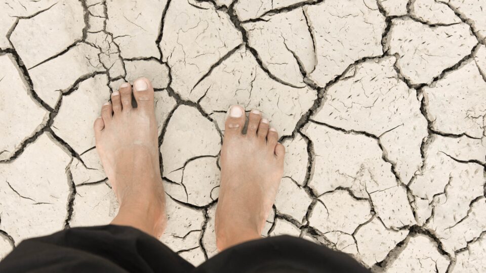 Dlaczego po lecie skóra i paznokcie naszych stóp wyglądają gorzej